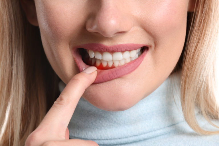 Jaki wpływ ma higiena jamy ustnej na odporność całego organizmu?